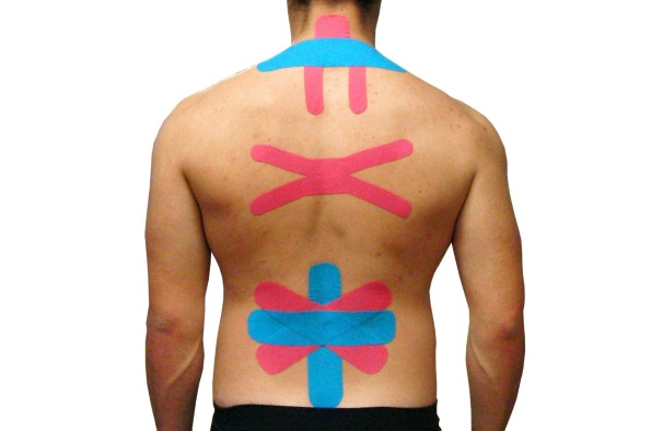 Тейпирование отделов позвоночника Тейпирование отделов позвоночника