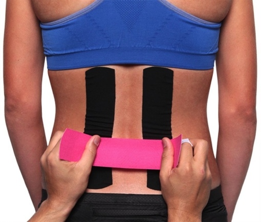 Тейпирование поясницы Тейпирование поясницы