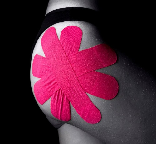 Тейпирование тазобедренного сустава Вариант 1