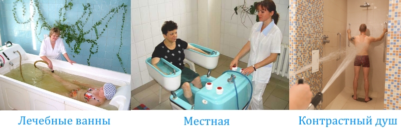 Основные типы бальнеотерапии Основные типы бальнеотерапии