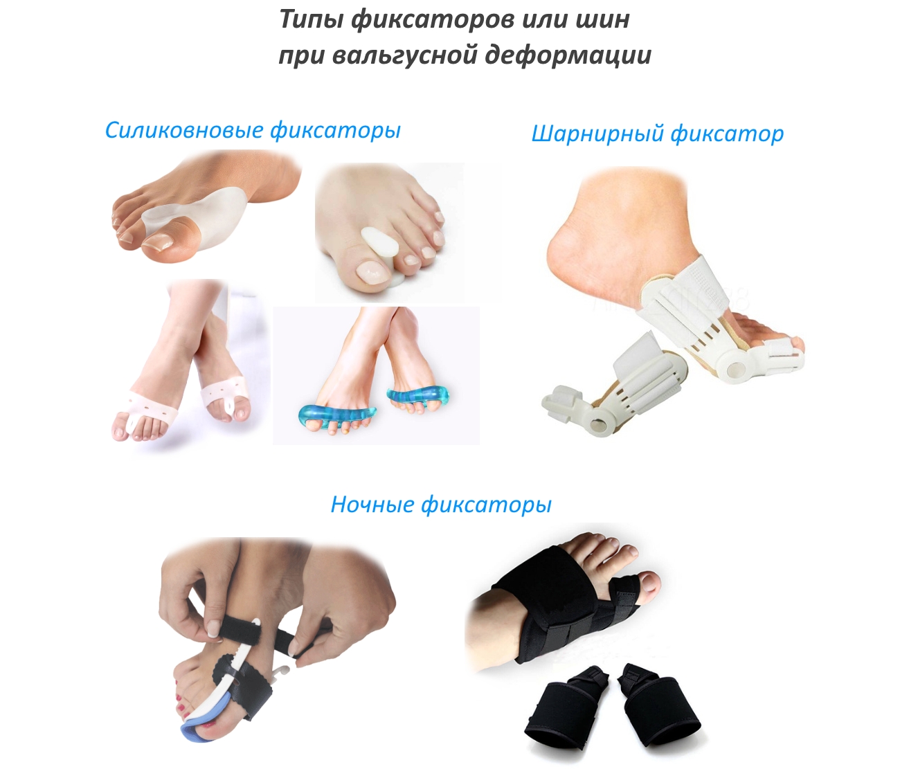 Типы фиксаторов от косточки на ноге Типы фиксаторов от косточки на ноге