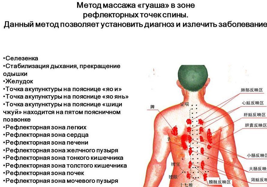 Точечная методика