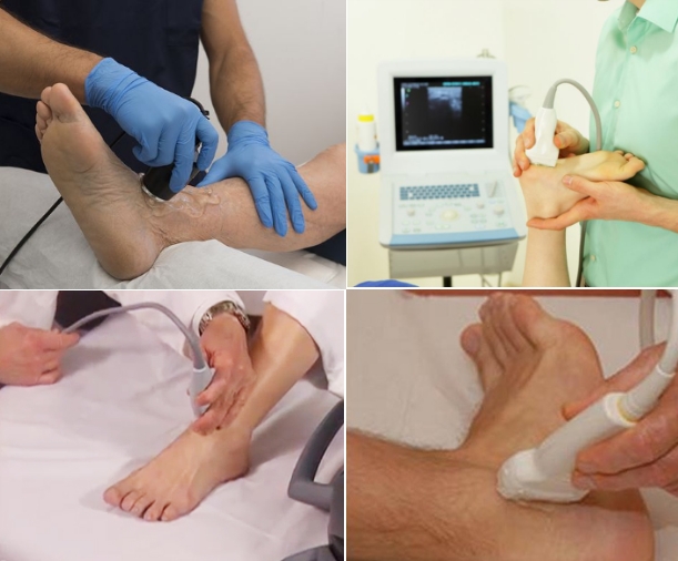 УЗИ стопы в разных проекциях УЗИ стопы в разных проекциях