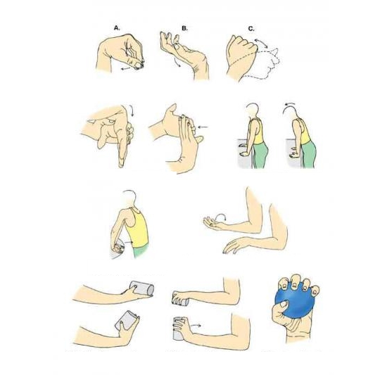 Упражнения при эпикондилите Упражнения при эпикондилите