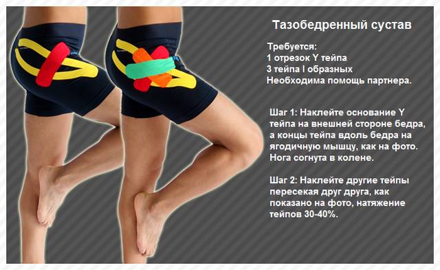 Варианты тейпирования тазобедренного сустава Варианты тейпирования тазобедренного сустава