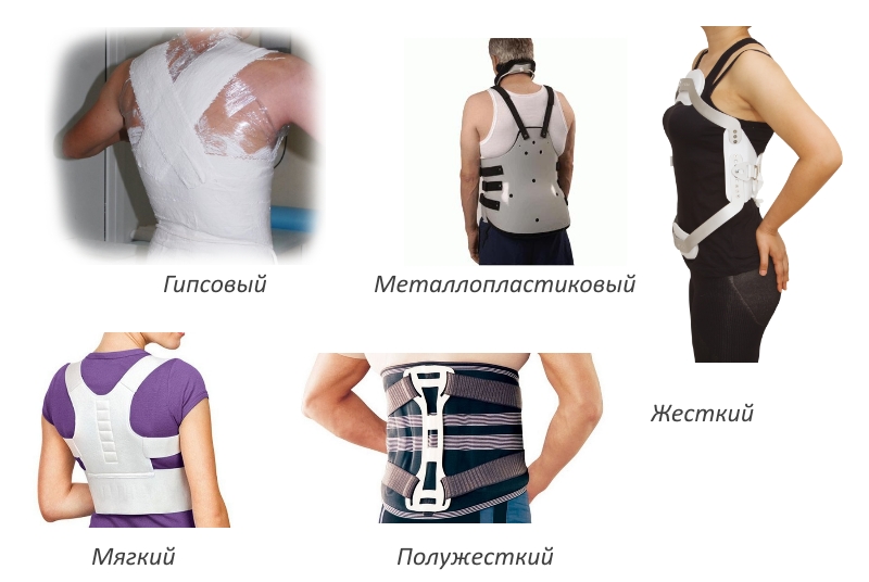 Виды корсетов при переломе позвоночника Виды корсетов при переломе позвоночника