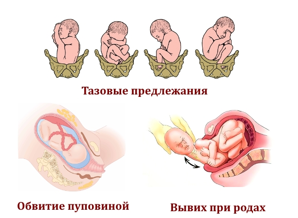 Врожденные причины подвывиха шеи Врожденные причины подвывиха шеи