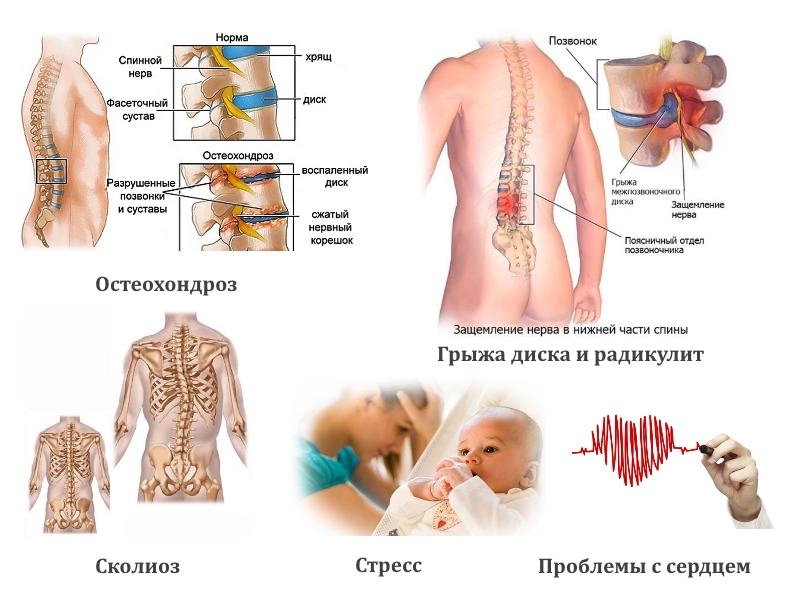 Возможные заболевания Возможные заболевания