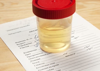 Анализ кальция в крови