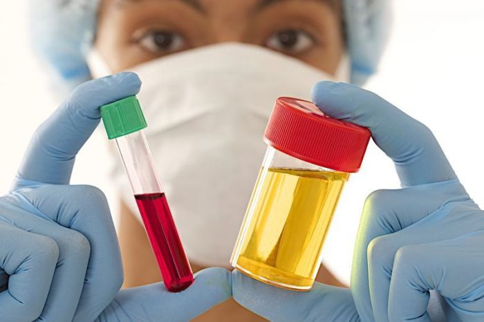 Сбор анализов