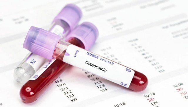 Анализ крови на остеокальцин