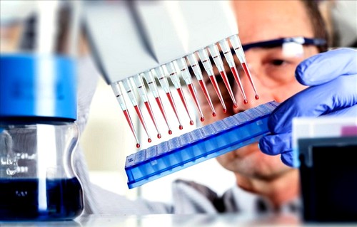 Анализ крови для диагностики остеопороза Анализ крови для диагностики остеопороза