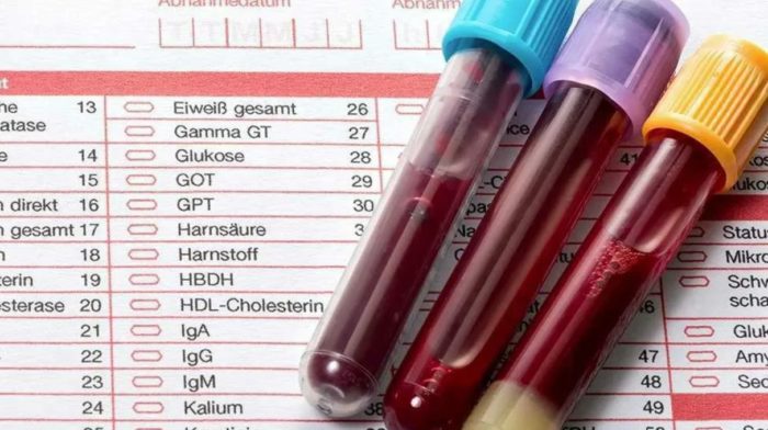 анализ на общий белок