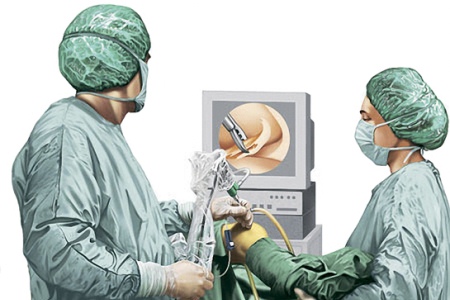 Артроскопия Артроскопия