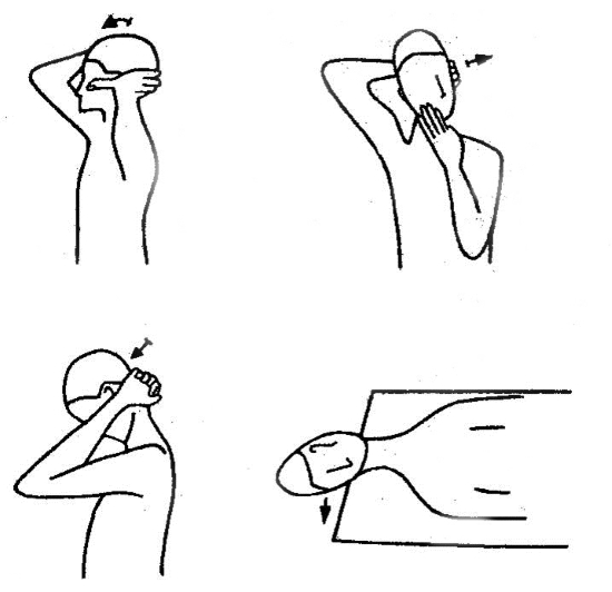 Аутомобилизация шеи Аутомобилизация шеи