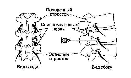 Блокада шейного нерва Блокада шейного нерва