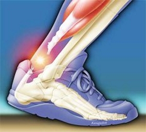 Боль при ходьбе Боль при ходьбе