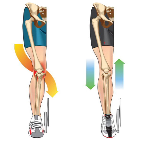 Боль при плоскостопии на велосипеде Боль при плоскостопии на велосипеде