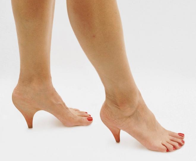 Боль при пяточных наростах Боль при пяточных наростах