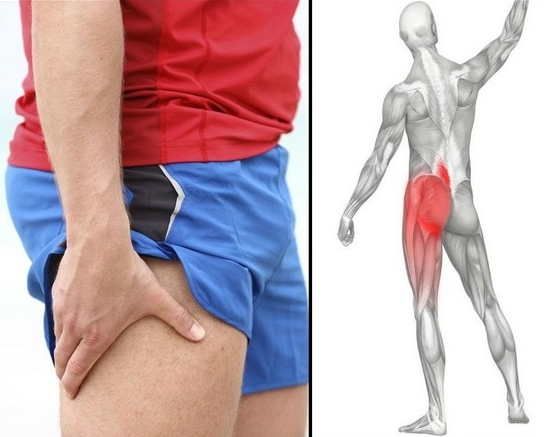 Боль в ноге при ишиасе Боль в ноге при ишиасе