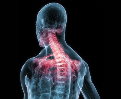 Боль в плечах и шее при шейном спондилоартрозе Боль в плечах и шее при шейном спондилоартрозе