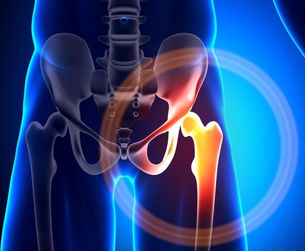 Боль в тазобедренном суставе Боль в тазобедренном суставе