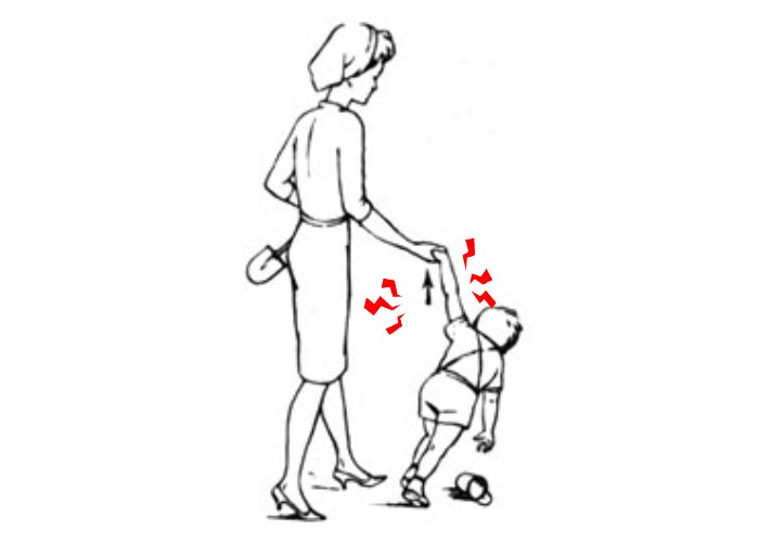 Боль в области локтя