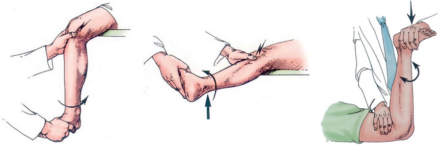 Болевые пробы мениска Болевые пробы мениска