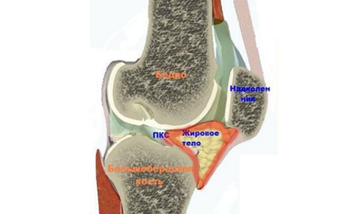 Воспаление жировой ткани при болезни Гоффа Воспаление жировой ткани при болезни Гоффа