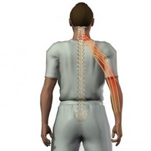 Боли при миелопатии шеи Боли при миелопатии шеи