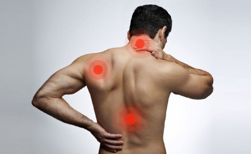 Боли при миозите Боли при миозите