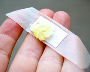 Чесночный компресс Чесночный компресс