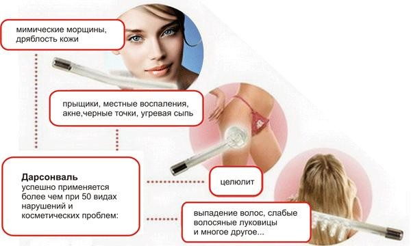Применение Дарсонваля Применение Дарсонваля
