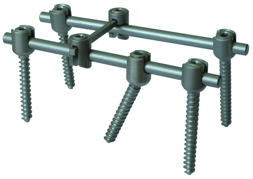 Деформация фиксатора