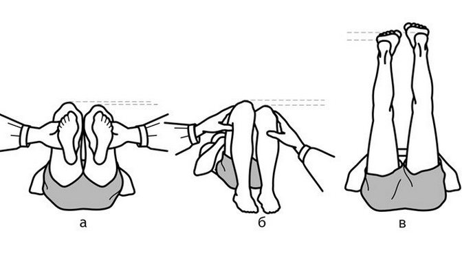 Деформация при вывихе тазобедренного сустава Деформация при вывихе тазобедренного сустава