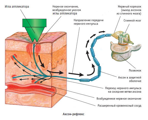 Действие аппликатора Кузнецова Действие аппликатора Кузнецова