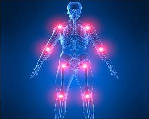 Проблемы с суставами