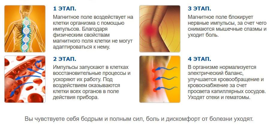Действие аппарата Алмаг Действие аппарата Алмаг