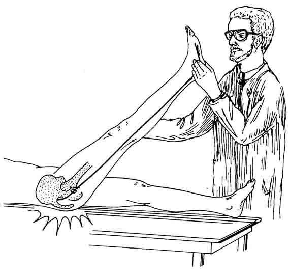 Болевой тест на синдром грушевидной мышцы Болевой тест на синдром грушевидной мышцы