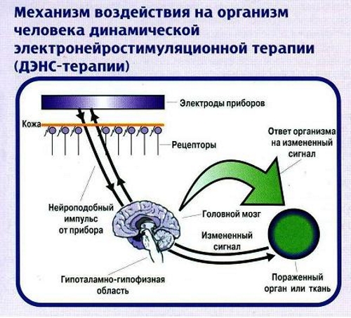 Динамическая электронейростимуляция