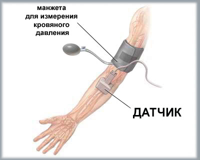 Допплерография сосудов рук Допплерография сосудов рук