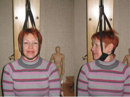 Движения головой при шейной тракции Движения головой при шейной тракции