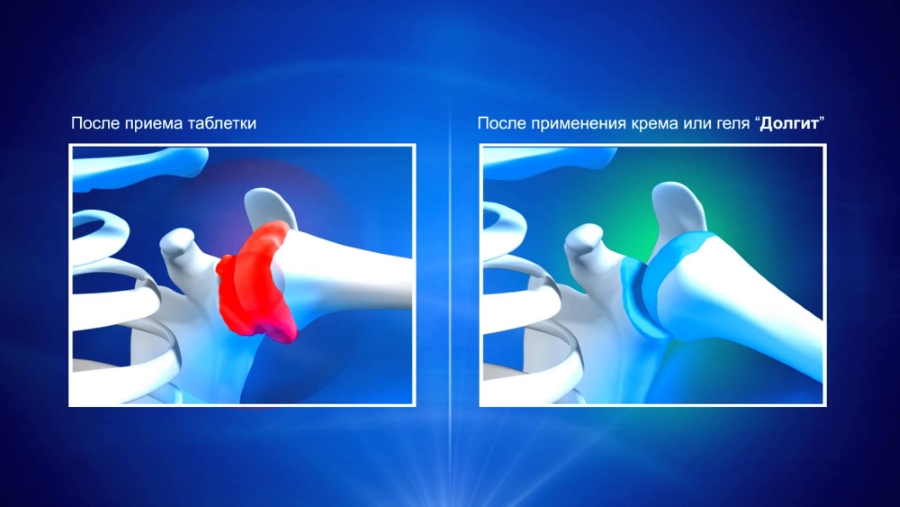 Эффект от геля Долгит