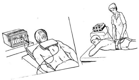 Электрофорез Электрофорез