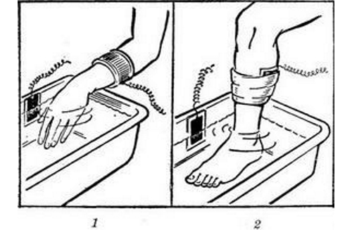 Электрофорез с магнезией для конечностей Электрофорез с магнезией для конечностей