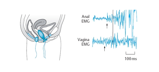 Электромиография таза Электромиография таза