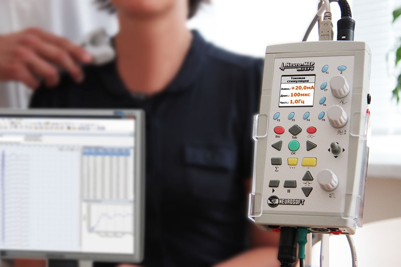 Проведение электронейромиографии