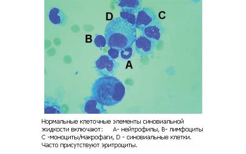 Элементы синовиальной жидкости Элементы синовиальной жидкости