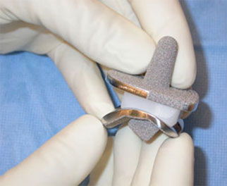 Эндопротез для стопы Эндопротез для стопы