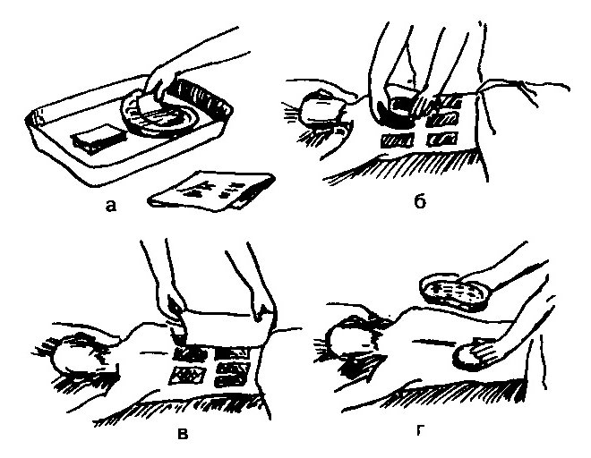 Этапы применения горчичников Этапы применения горчичников